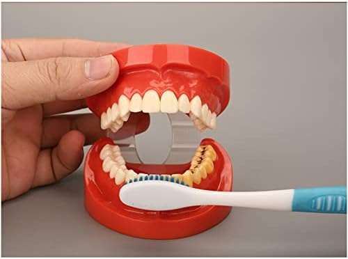 KH66ZKY Fogszuvasodás Fogat Modell - Bomlás Fogat Modell - Standard Fogak Oktatási Modell, Tanulmány Eszköz, Felnőtt Betegség Standard Typodont