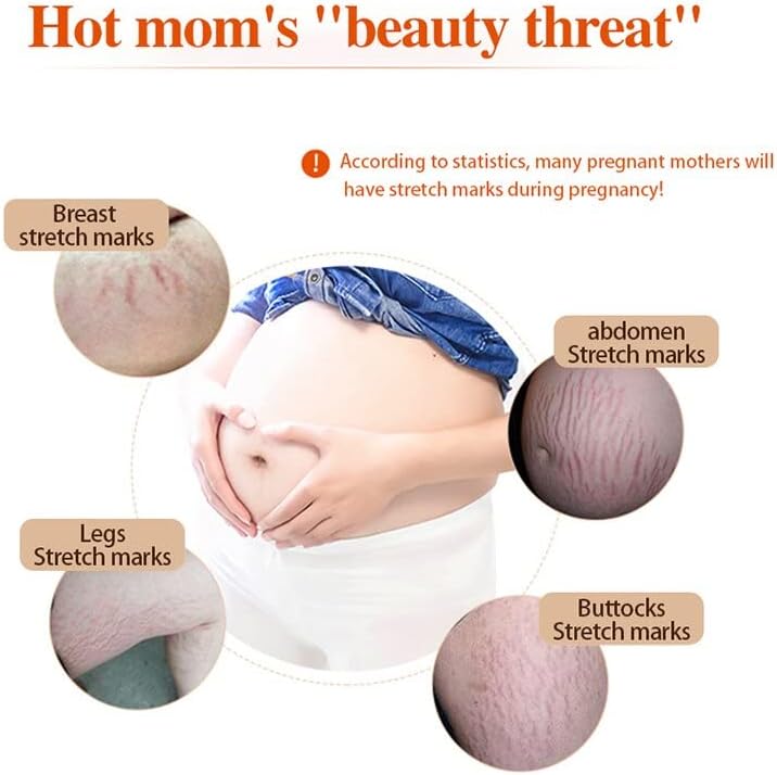 30g Távolítsa el a Terhesség Hegek, Pattanások Krém striák Kezelésére Emelő Bőr Feszesítő Fogfehérítés Test bőrápolás